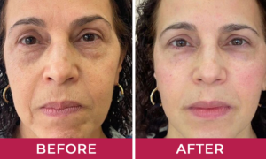 Hydralyft Face Mask Doloris