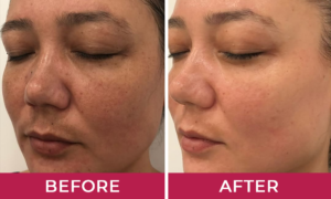 Hydralyft Face Mask Luzita