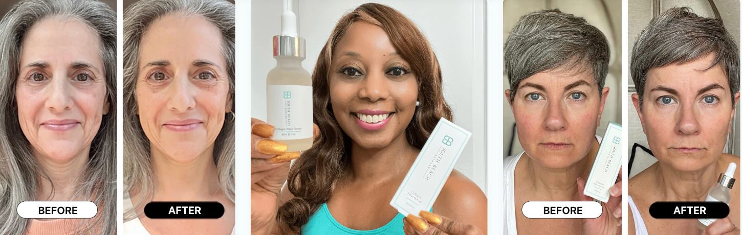 South Beach Collagen Filler Serum Customers